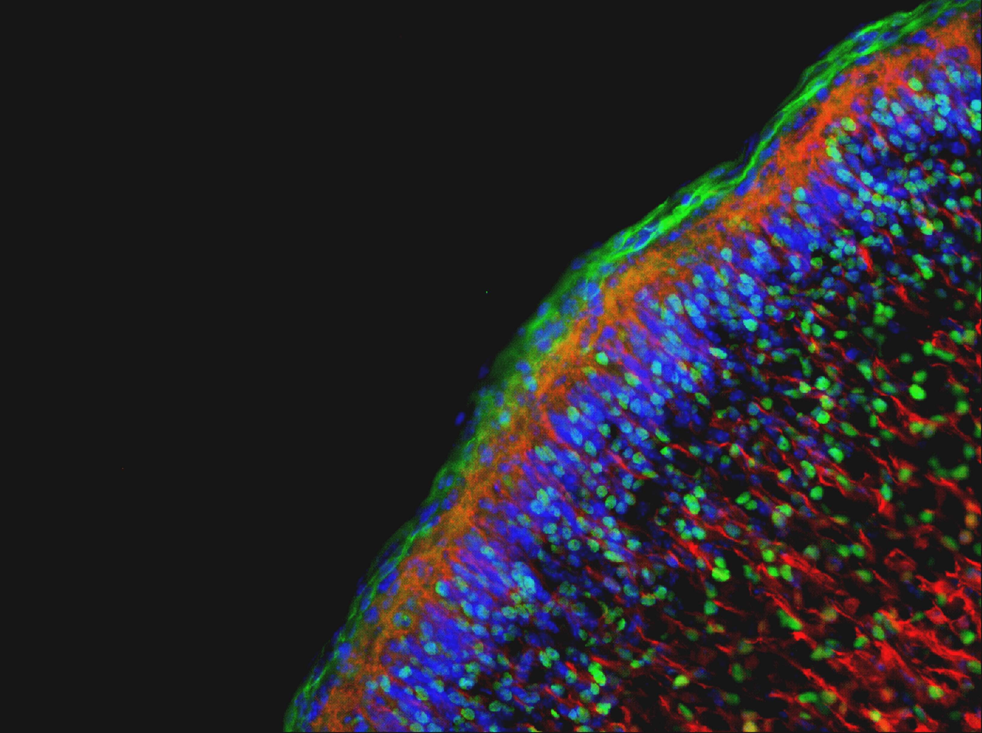 Fluorescent labeling of cells in slice of brain tissue